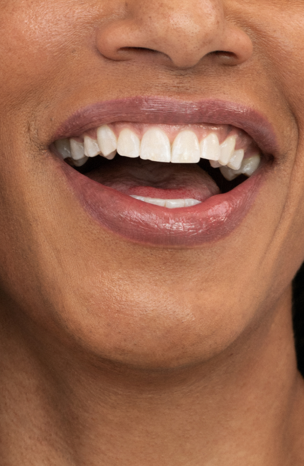 Elegant Smile